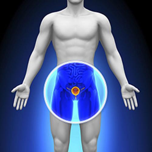 biopsia della prostata