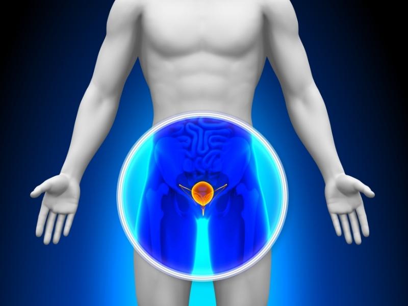 cancro alla prostata