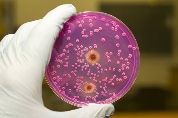 Candida uomo cause sintomi e cura della candida maschile