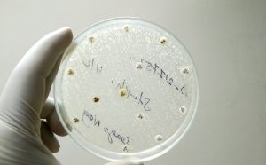 Candida uomo cause sintomi e cura della candida maschile