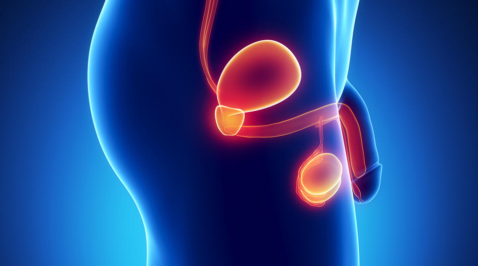 Il Varicocele - | Prof. Laganà Urologo - Andrologo Roma