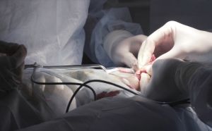 tumore della prostata terapia o Prostatectomia