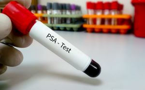 Diagnosi tumore della prostata