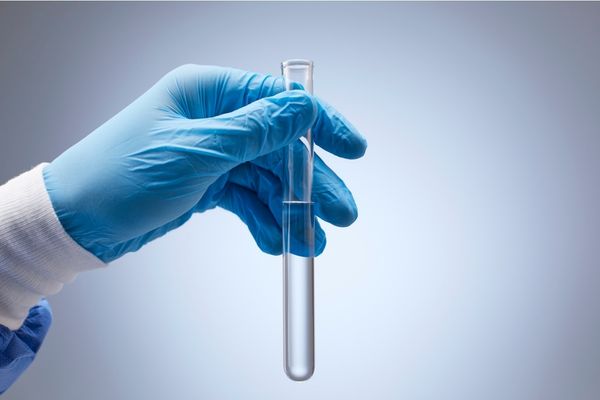 Secrezioni peniene