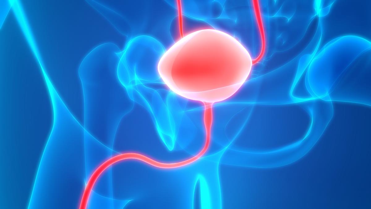 Stenosi Uretrale