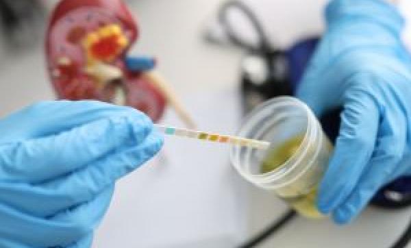 Sangue nelle urine