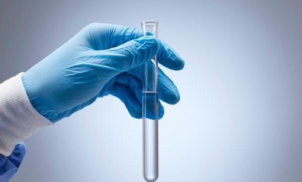 Secrezioni peniene