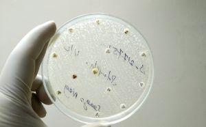 Candida uomo cause sintomi e cura della candida maschile