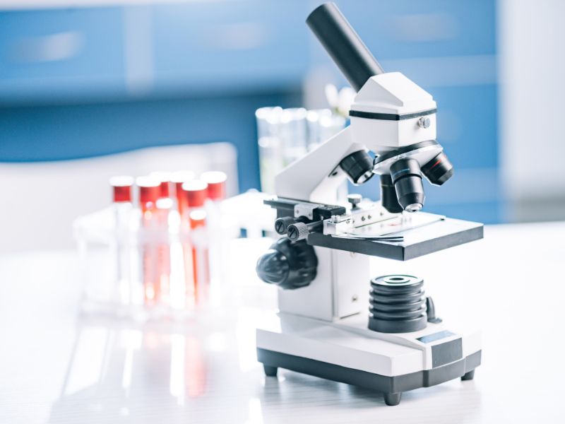 test psa per la diagnosi della prostata ingrossata